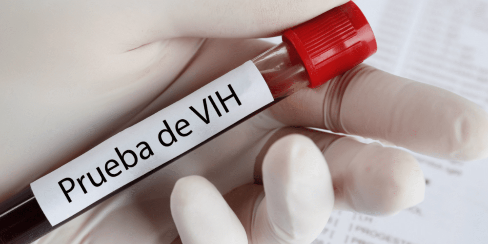 VIH cobra 63 vidas en lo que va del año