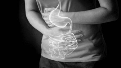 Infecciones intestinales en Campeche aumentan con el calor Secretaría de Salud alerta sobre prevención