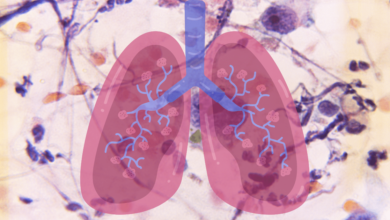 Enfermedades pulmonares las cinco afecciones más comunes en América Latina