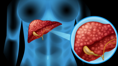 Huauzontle la planta mexicana que limpia los riñones, combate el hígado graso y fortalece los huesos