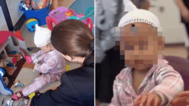 Jazlyn Azuleth muestra avances en su recuperación tras explosión en Iztapalapa