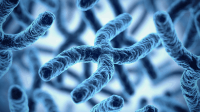 Síndrome 22q11 características y diagnóstico clave