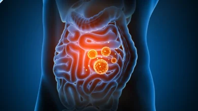 infecciones intestinales superan 10 mil en campeche