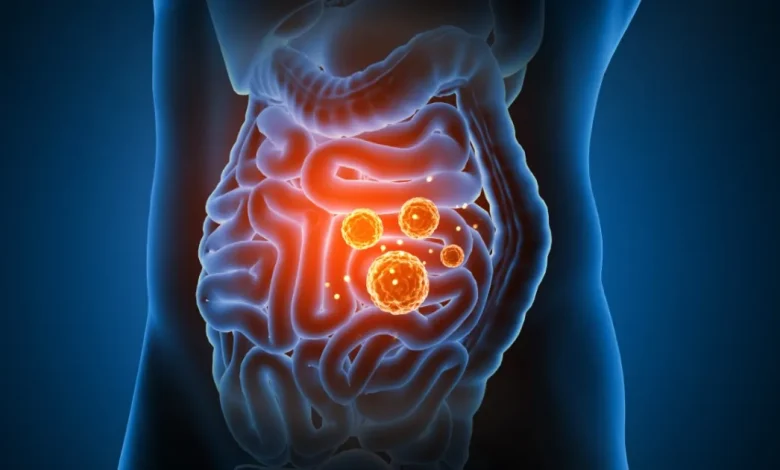infecciones intestinales superan 10 mil en campeche