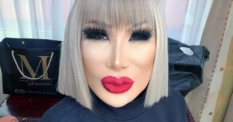 lyn may revela cómo vivió el cambio en su rostro